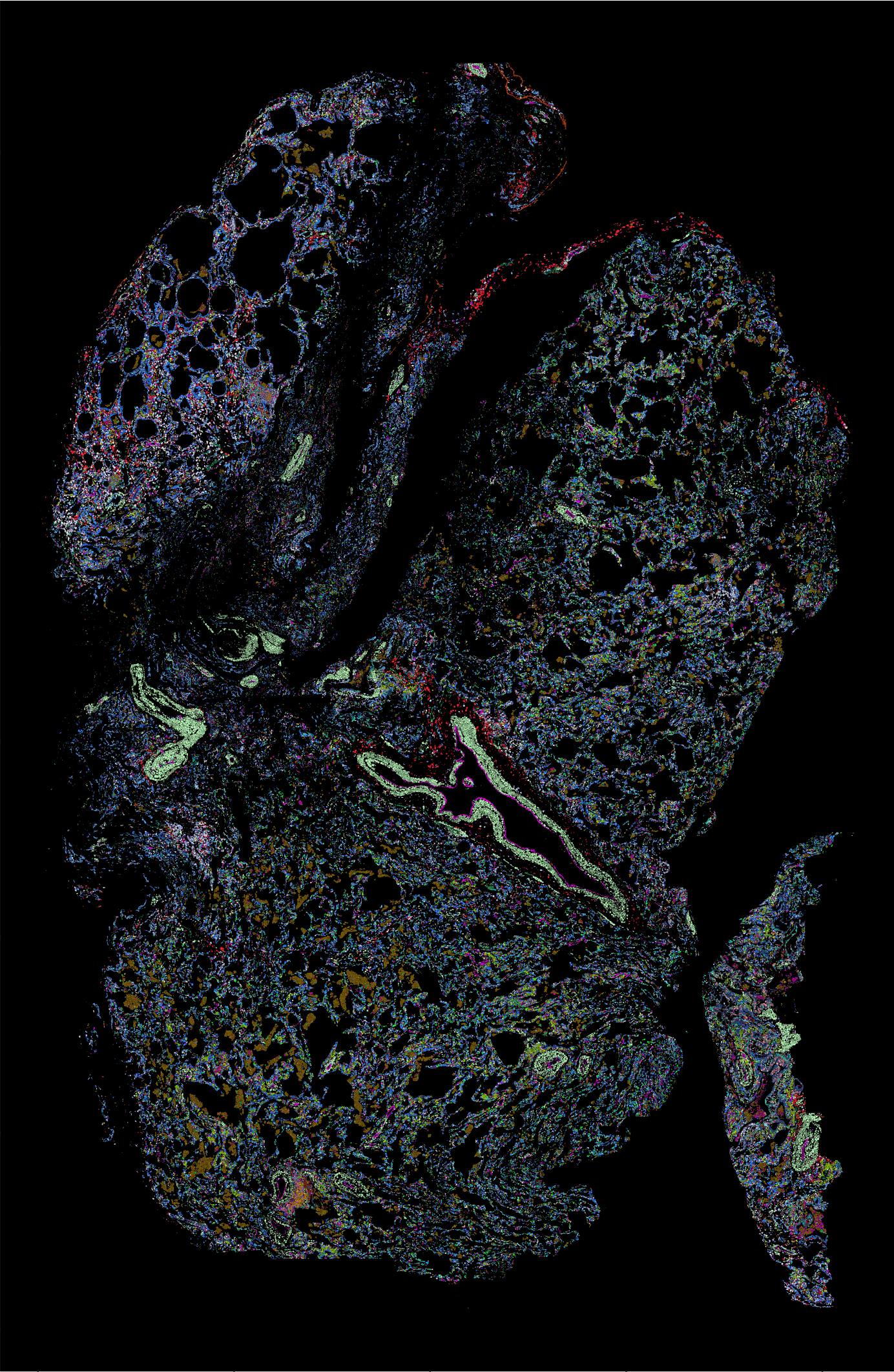 Human Lung Data-Xenium (Collab between CCP and 10X)